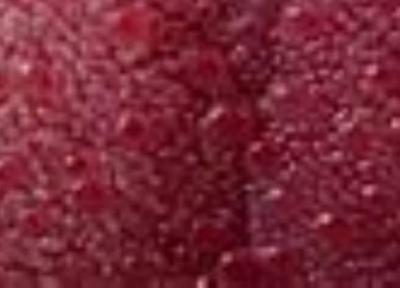 التهاب پرزهای چشایی التهاب پرزهای چشایی